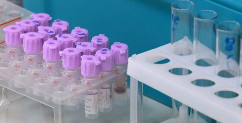 Виды вирусов и их лечение. Эксперты об эпидситуации в Беларуси