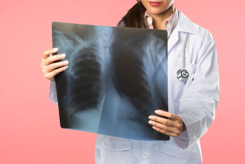 Анколагі расказалі, якія пухліны выклікае тытунь і ці можна іх выявіць на ранніх стадыях