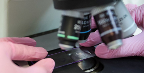 Вучоныя стварылі ДНК-нанасэнсары, здольныя выяўляць розныя формы раку мозгу па аналізе крыві