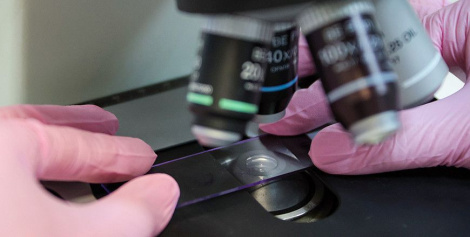 Кіраўнік Акадэміі навук аб новых распрацоўках у анкалогіі